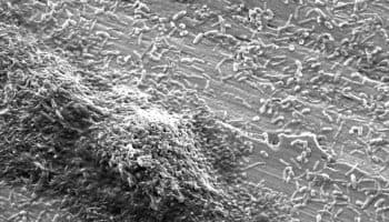 Confirman que brote de neumonía en Argentina lo ocasionó la bacteria legionella