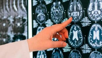 Asocian dos químicos habituales en los hogares al desarrollo de enfermedades cerebrales