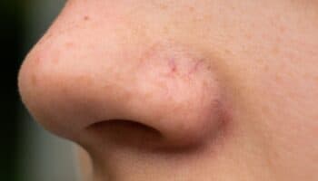 Alucinaciones Olfativas #Niñonautas con Kirén Miret