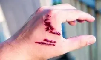 Murciélago provoca alerta sanitaria por rabia humana en Veracruz